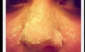 Blackhead Removal | Does it Work? | DIY Series |