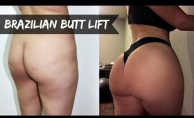 Is my butt real? Fat Transfer/BBL ✖ MY EXPERIENCE