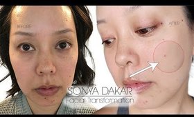 most dramatic before & after results facial treatment w/ Sonya Dakar | Serein Wu