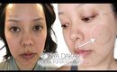 most dramatic before & after results facial treatment w/ Sonya Dakar | Serein Wu