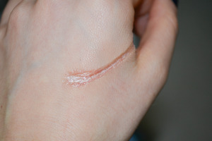 Special FX scar on the hand 
