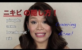 Covering an Acne ニキビの隠し方 - bulaklaklavapie