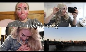 ACNE FLARE UP | Weekly #69