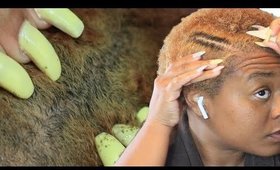 2 weeks of hair growth. After Watching This You Will Never THROW AWAY ONION SKIN AGAIN!