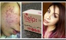 Get 'Clear Skin' 25% OFF | Natural Acne & Blemish Solution | TheRaviOsahn