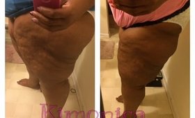 Thighs/Legs Update Cellulite | After 241 weight loss