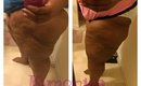 Thighs/Legs Update Cellulite | After 241 weight loss