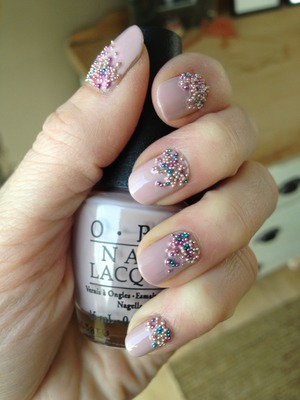 NCL pearls on OPI