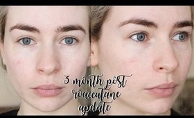 3 MONTHS POST ROACCUTANE SKIN UPDATE!