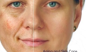 Aging and Skin Care