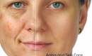 Aging and Skin Care