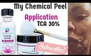 How To Properly Do A Chemical Peel  & Not Burn Your Skin | TCA 30% |DivasGlamSquad