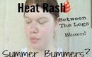 Summers Bummers: Chafing solutions