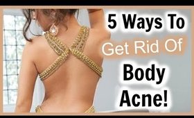 5 Ways I CURED My Body Acne! │ Get RID of Body Acne FAST