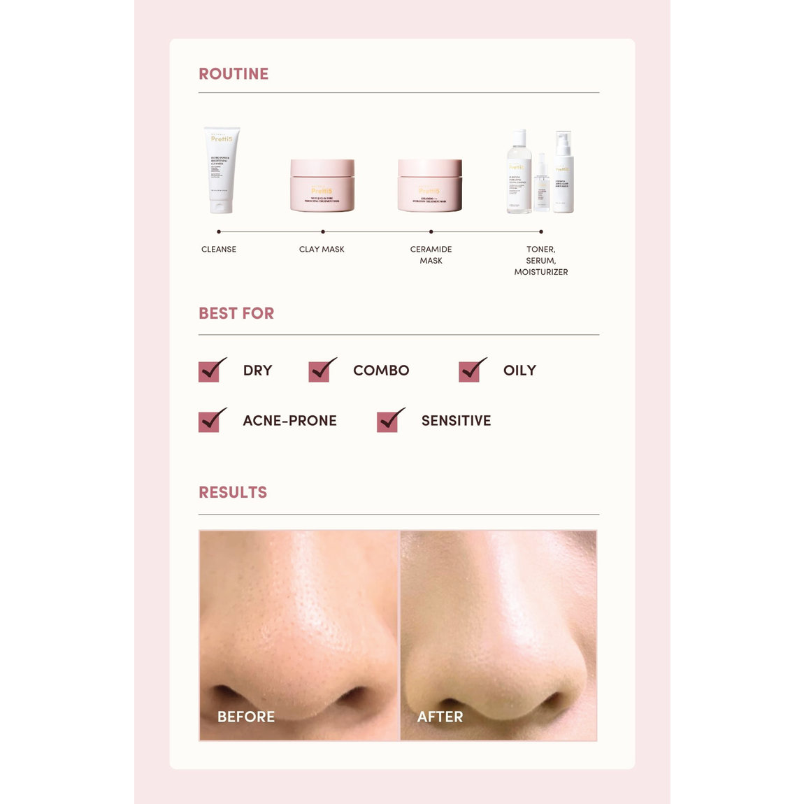Pretti5 Mt. Fuji Clay Pore Perfecting Treatment Mask |