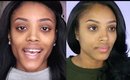 Removing DARK CIRCLES: (My Under Eye Fillers Experience)