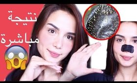 3 خطوات لازالة الرؤوس السوداء من الاعماق | BYE BYE BLACKHEADS