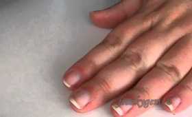 How To Soothe A Hang Nail