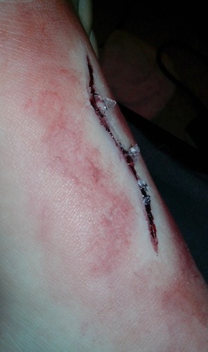 cut on the foot with fake glass
