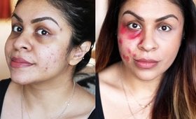 HOW TO: Use RED LIPSTICK To Cover Acne Scars, Blemishes & Dark Under Eye Circles