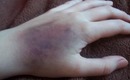 SFX: How To Create A Bruise With Makeup