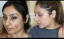 Vitamins for clear skin No more acne cystic acne | Raji Osahn