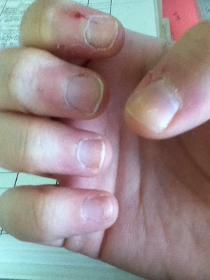 My Nails are Hell. | Beautylish