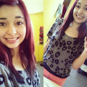 My red hair. 