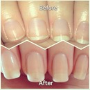 Before and After nail growth!