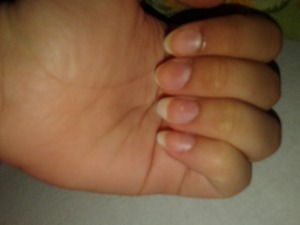 Broken nails REALLY UPSET!! | Beautylish
