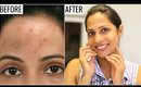 Best SKINCARE ROUTINE for Crystal Clear Skin | Shruti Arjun Anand
