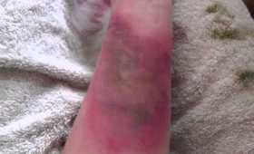 Special FX Bruising and Scaring Turoial