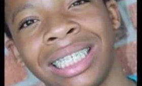 September 21, 2016  My oldest autistic Son Got his braces Y'all