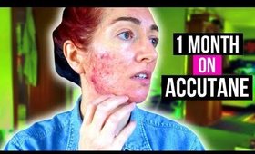 1 MONTH ON ACCUTANE! Acne Update + Scary Aussie Countryside VLOG | Jess Bunty