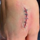 'Stitches'