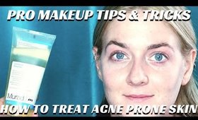 PRO ARTIST TIPS- HOW TO TREAT ACNE PRONE SKIN VIDEO / CLEANSING ROUTINE- mathias4makeup