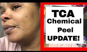 How To Use TCA Chemical Peel At Home Update Day 3 & 4