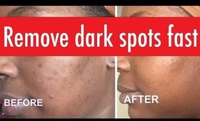 Skin care faves DARK SPOT removal & anti-aging