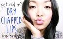 HOW TO: Get Rid of Dry, Chapped Lips INSTANTLY!