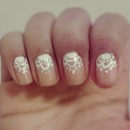 Lace nails