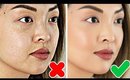 HOW TO: Get Rid Of Hyperpigmentation & Dark Spots FAST!