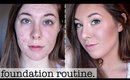 Foundation Routine // Easily Cover Acne, Scars, + Hyperpigmentation