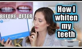 HOW I WHITEN MY TEETH + GIVEAWAY | SMILE BRILLIANT