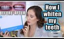 HOW I WHITEN MY TEETH + GIVEAWAY | SMILE BRILLIANT