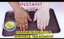 Skin Whitening Home Remedy For Dark Knuckles Wrinkle Treatment Sun Tan Removal | SuperPrincessjo