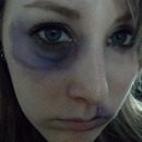 Bruised Face