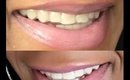 White with Style Teeth Whitening System Demo and Results!