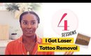 I Completed My Laser Tattoo Removal Sessions
