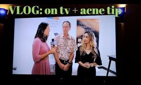 NEW TV EPISODE, CAN SUN CAUSE ACNE?