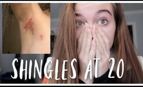 Getting Shingles At 20 Years Old